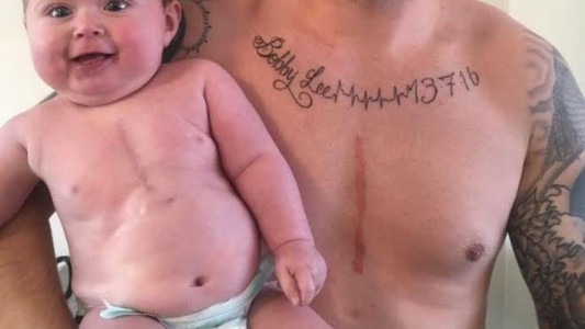 Un padre se tatuó la cicatriz que su hijo tiene tras ser operado a corazón abierto