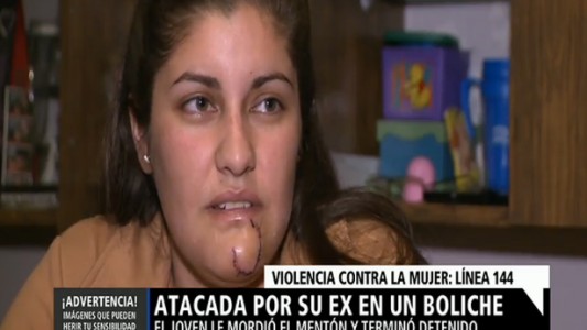 Su ex la encontró en un boliche, la atacó y de una mordida le arrancó parte del mentón