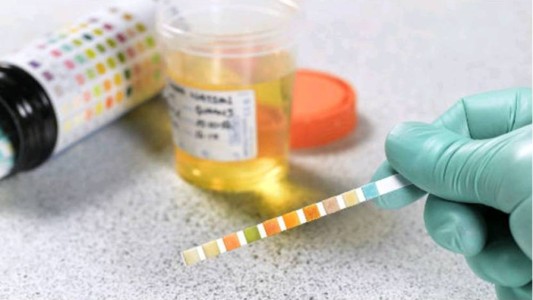 La historia del hombre que se alimenta de su propia orina