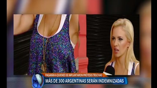 Siliconas, implantes y juicio: indemnizarán a 300 argentinas