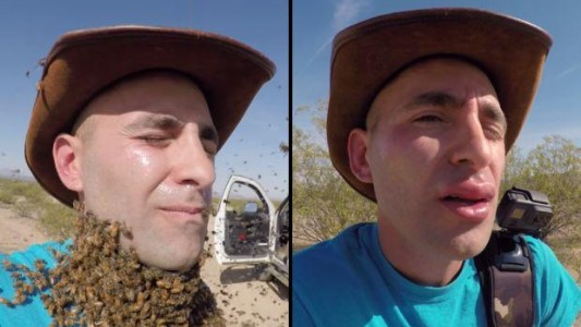 Viral escalofriante: así le quedó la cara tras colocarse tres mil abejas