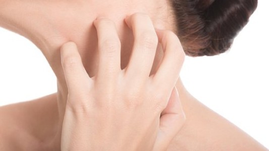 Campaña para detectar una rara enfermedad en la piel que afecta a medio millón de argentinos