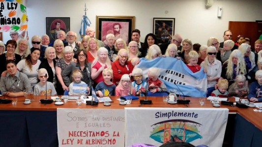 Albinismo: curiosidades, discriminación y un proyecto de ley esperanzador