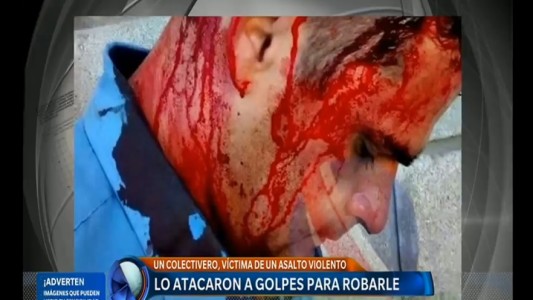 Otro colectivero resultó herido en un asalto