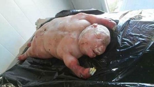 Pánico y misterio en Sudáfrica por el nacimiento de un "cordero-hombre"