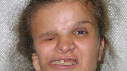 Una niña abandonada se somete a una operación de estética para volver con su familia y muere en el quirófano