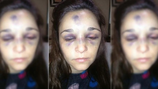 Está muy grave una mujer que fue golpeada por su pareja, un boxeador de 17 años