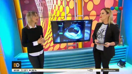 Baires Directo Bloque 2 12/07/2017