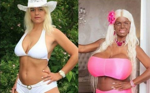 La asombrosa transformación de la "Barbie exótica": cambió el color de su piel y se agrandó los pechos