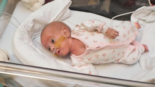 Sobrevivió un bebé prematuro que era grande como una pelota de tenis cuando nació