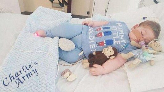 "Es demasiado tarde" dijeron los padres del bebito Charlie Gard y aceptaron que ya no es posible salvarlo