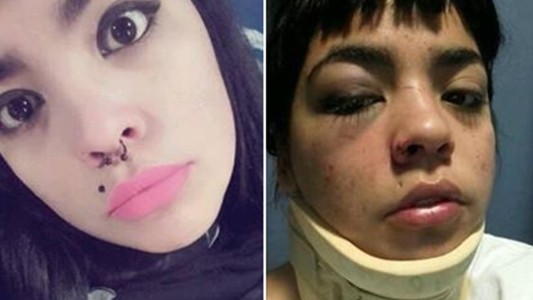 Ataque violento en Bahía Blanca: una joven denunció que la golpearon e intentaron violarla