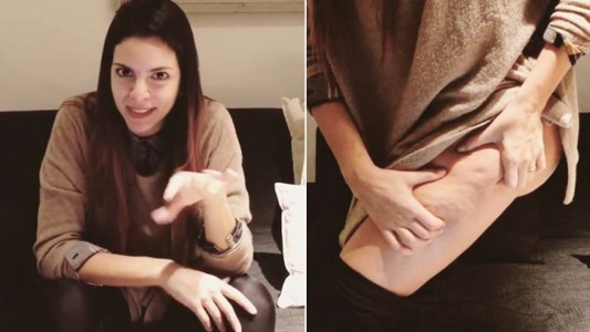 "Aguante las mujeres reales con celulitis", el video de una instagramer que es furor en las redes