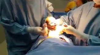 Video polémico: médicos zamarrean a un bebé durante el parto y lo hacen "alentar" por Independiente