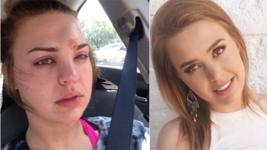 Se explotó un granito y casi termina en tragedia