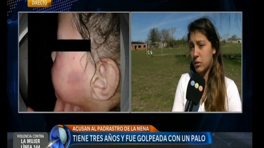 Acusan a un hombre de golpear a su hijastra y maquillarla para cubrir las marcas