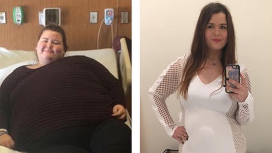 La joven que bajó 92 kilos tras la advertencia de su madre