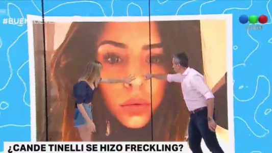 El rostro de Candelaria Tinelli: qué es el freckling