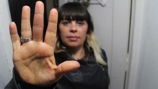 Doblaba la ropa en su casa, la picó una araña y estuvo 2 días internada