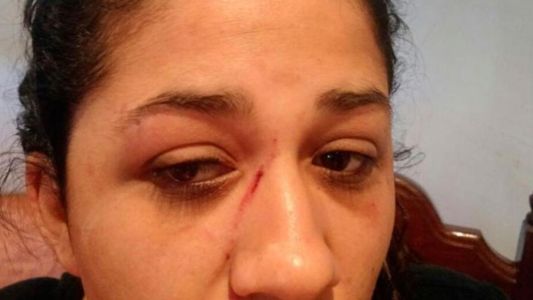Una mujer recibió un botellazo en medio de una discusión de tránsito, le dieron 25 puntos