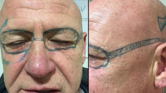 Le tatuaron unos anteojos en la cara en una despedida de solteros y tardó dos años en borrarse el dibujo