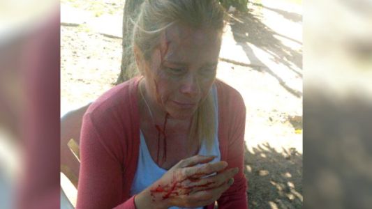 Fue al cementerio a visitar la tumba de su mamá, quisieron robarle y la agredieron brutalmente