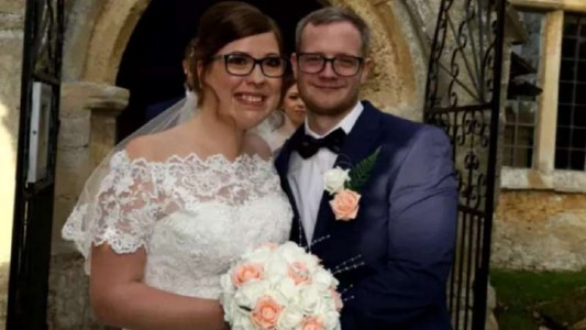 El emotivo mensaje de la chica que nació con una severa deformidad en la cara y se casó a los 25 años