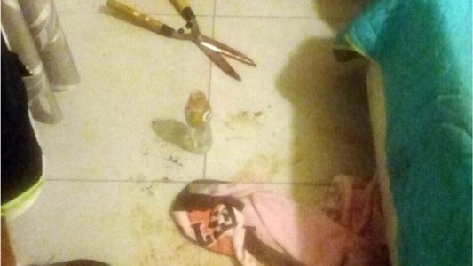 Una mujer fue detenida tras cortarle el pene a su amante con una tijera de podar
