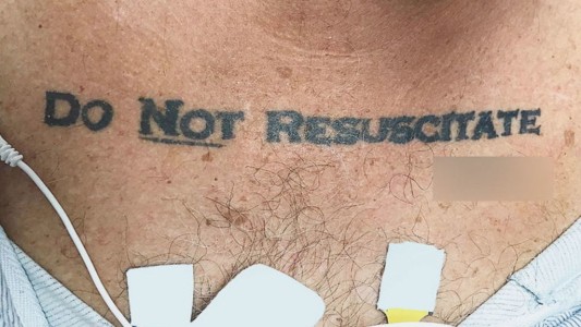 Un hombre llega inconsciente al hospital y los médicos se enfrentaron con este tatuaje