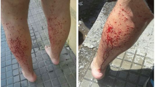 Catamarca: policía disparó con balas de sal a chicos que festejaban el fin del ciclo lectivo