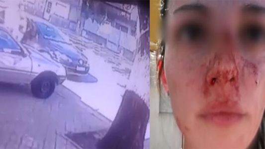 Brutal agresión: su ex la golpeó en la calle y delante de su hijo de cinco años
