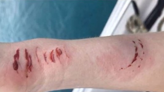 La ataca un tiburón mientras su esposo la filmaba en la luna de miel