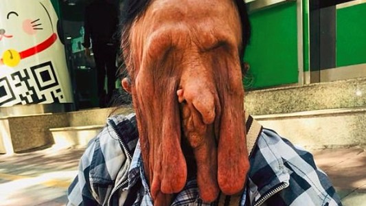 El extraño caso de la mujer con la "piel derretida" que no quiere operarse por miedo a morir