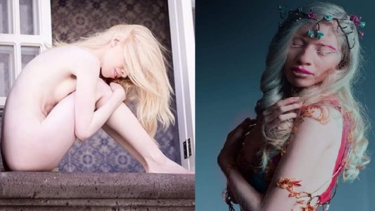 "Ser diferente es una bendición": la historia de la joven albina que se hizo modelo para enfrentar a la discriminación