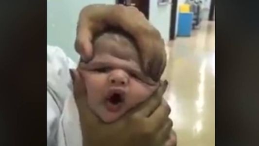 Video: despidieron a tres enfermeras por maltratar a un bebé recién nacido