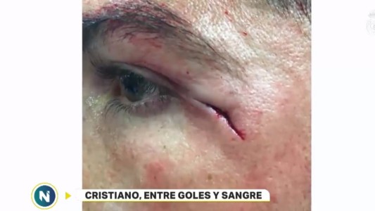 Cristiano Ronaldo, entre goles y sangre
