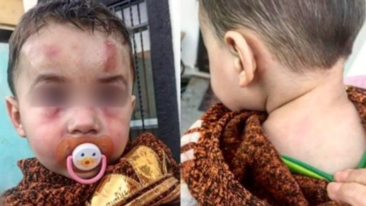 Horror en México: un bebé fue brutalmente golpeado en una guardería