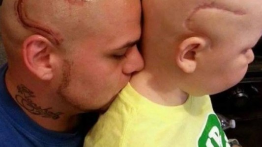 Murió el nene, cuyo papá se había tatuado en la cabeza una cicatriz para hacerlo sentir mejor
