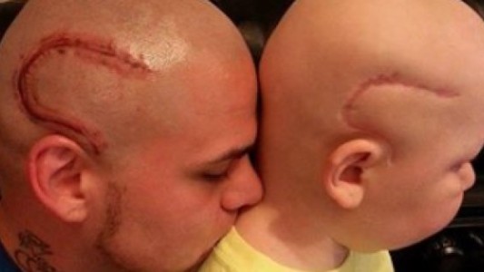 La conmovedora carta de despedida de padre que se tatuó en la cabeza la cicatriz que tenía su hijo