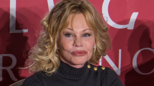 ¿Qué le pasó a Melanie Griffith en la nariz?