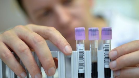 Se triplicaron los casos de sífilis en la Argentina entre 2011 y 2017