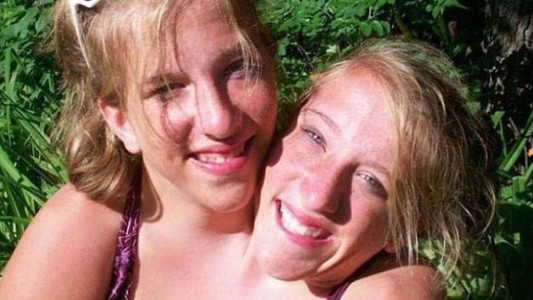 El extraño caso de las hermanas siamesas que se recibieron de profesoras de matemáticas