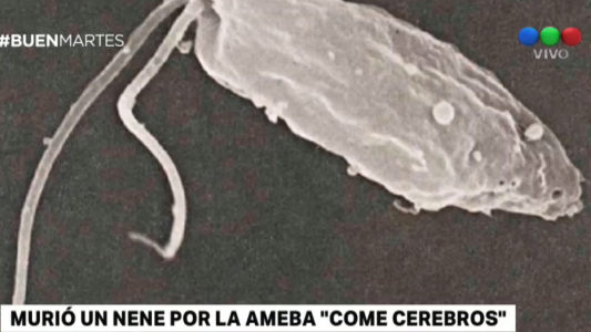 Un nene de 8 años murió por la ameba "come cerebros"