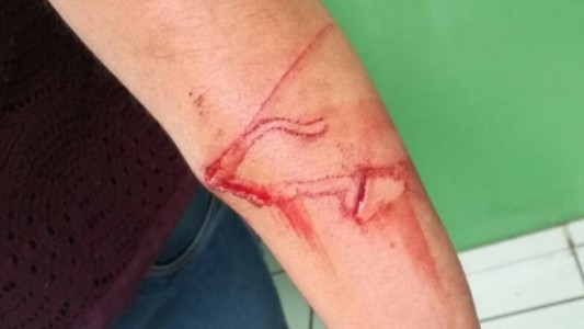 Un nene de 10 años acuchilló a su maestra para cumplir con un desafío viral