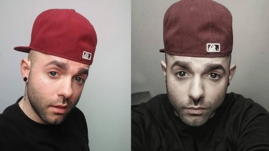 Sobrevivió al cáncer, se tatuó por completo el rostro de gris y ahora parece un negativo