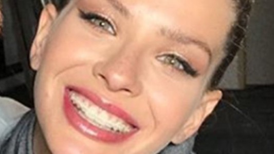 La sonrisa de la China Suárez sin brackets