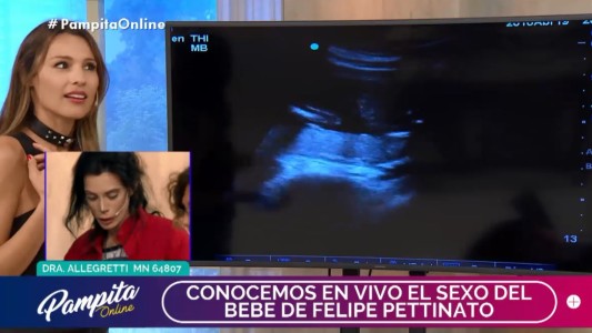 La novia de Felipe Petinato se hizo una ecografía en vivo: cuál es el sexo del bebé?