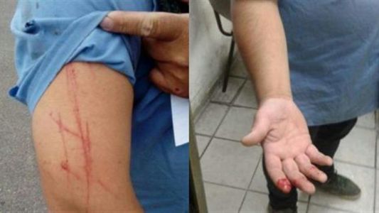 Otro ataque a un colectivero: acuchillaron a un chofer en Pablo Podestá