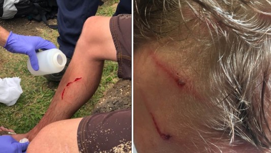 El hombre más odiado por animales: sobrevivió a ataques de tiburón, oso y serpiente