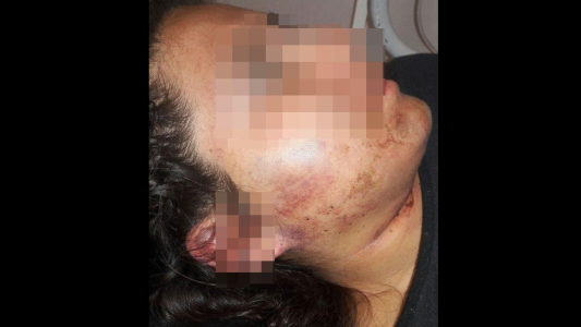 Salta: entregó a una joven a sus amigos, la violaron en grupo e intentaron ahorcarla